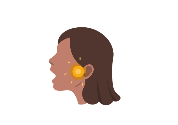 Eine Illustration des Seitenprofils einer Frau mit offenem Mund. Von ihrem Kiefer gehen gelbe konzentrische Kreise sowie fünf Linien aus, die den Schmerz anzeigen.