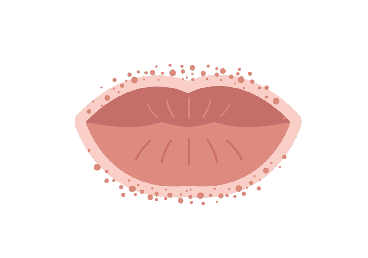 On clear lip bump What Causes