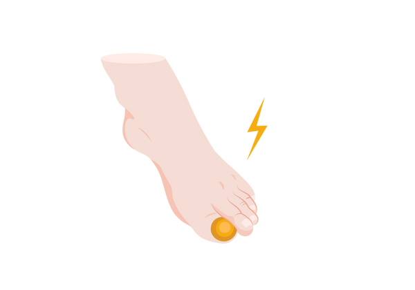Big Toe Pain: 8 Causes & How to Find Relief | Buoy