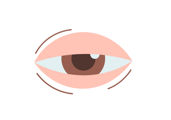 An illustration of an eye with the eyelids covering the top and bottom third of the eye. The iris is brown and the pupil is dark brown. Three brown lines surround the edges of the eyelid.