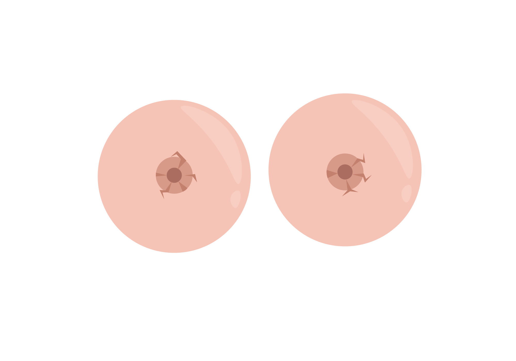 Itching breast, areola, nipple, bust: how do I get relief?