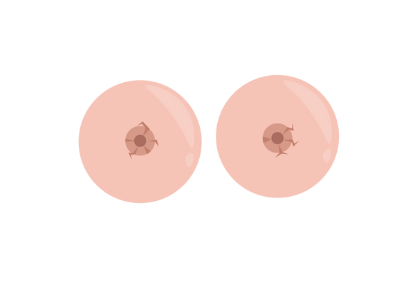 Two pink breasts with brown cracks on the nipples.