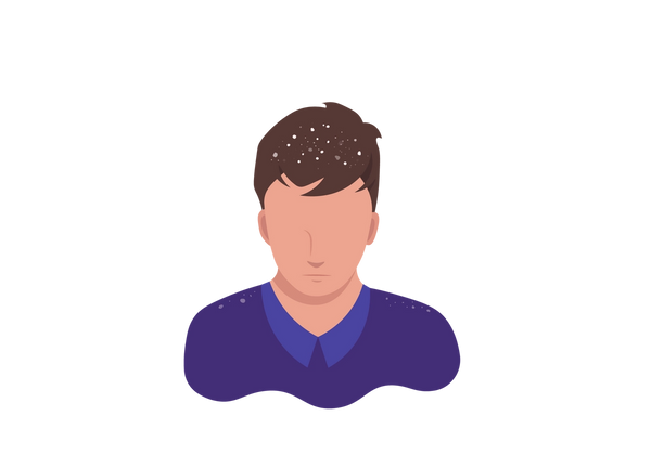 Una ilustración de un hombre con la cabeza ligeramente inclinada hacia abajo. Copos blancos son visibles en su cabello castaño. Lleva una camisa con cuello de color púrpura oscuro y algunas escamas son visibles en sus hombros.