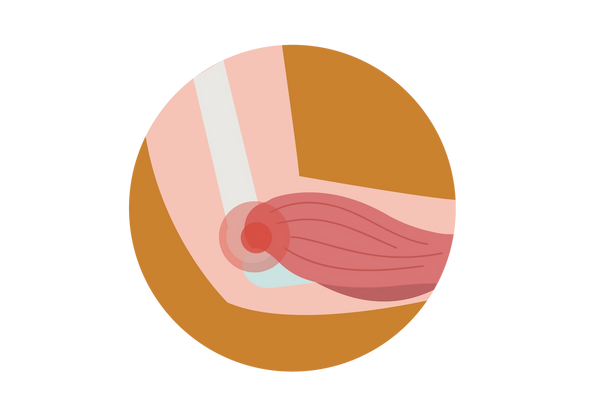 Une image en gros plan d'un coude avec les os et les muscles visibles. Un cercle rouge se trouve au-dessus du coude, rayonnant un autre cercle concentrique.