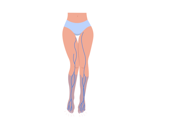 Eine Illustration einer Frau von der Hüfte abwärts. Sie trägt nur hellblaue Unterwäsche. Mittelblaue Nerven verlaufen über ihre nackten Beine und ihre Waden sind blau gefärbt.