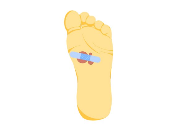 Eine Illustration eines gelben Fußes, die die Unterseite des Fußes zeigt. Es gibt drei rote Läsionen, die durch einen hellblauen Verband schlecht abgedeckt sind. Der Verband deckt die Läsionen nicht ausreichend ab und sie liegen teilweise frei.