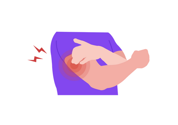 An illustration of a man's torso and arms from a three quarter view facing slightly right. He is touching a spot on his right arm with his left hand. The spot is a red circle with three red translucent circles coming from it, and two red lightning bolts come from it as well. He has light peach-toned skin and is wearing a short-sleeved purple shirt.