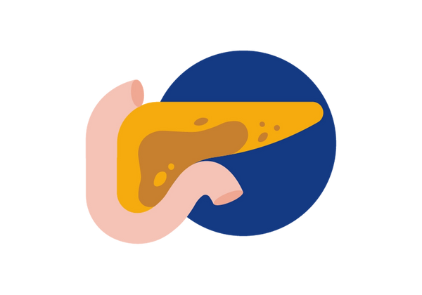 A pancreas with an inflammation.