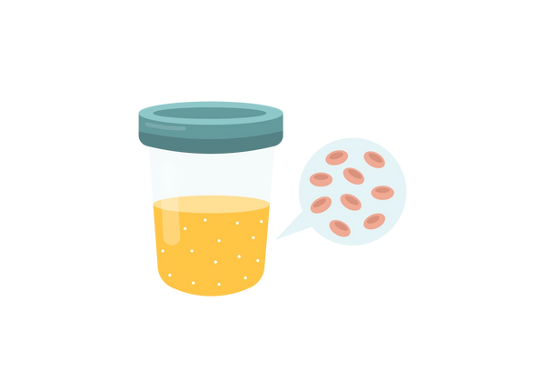 Una copa de muestra con una tapa verde llena hasta la mitad con líquido amarillo. A la derecha hay un globo de diálogo de color azul claro con glóbulos de color rosa claro.