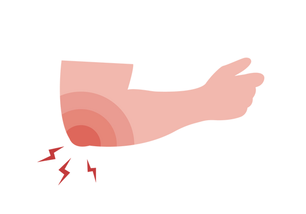 A bent arm. Red emanates from the elbow, along with three red lightning bolts.