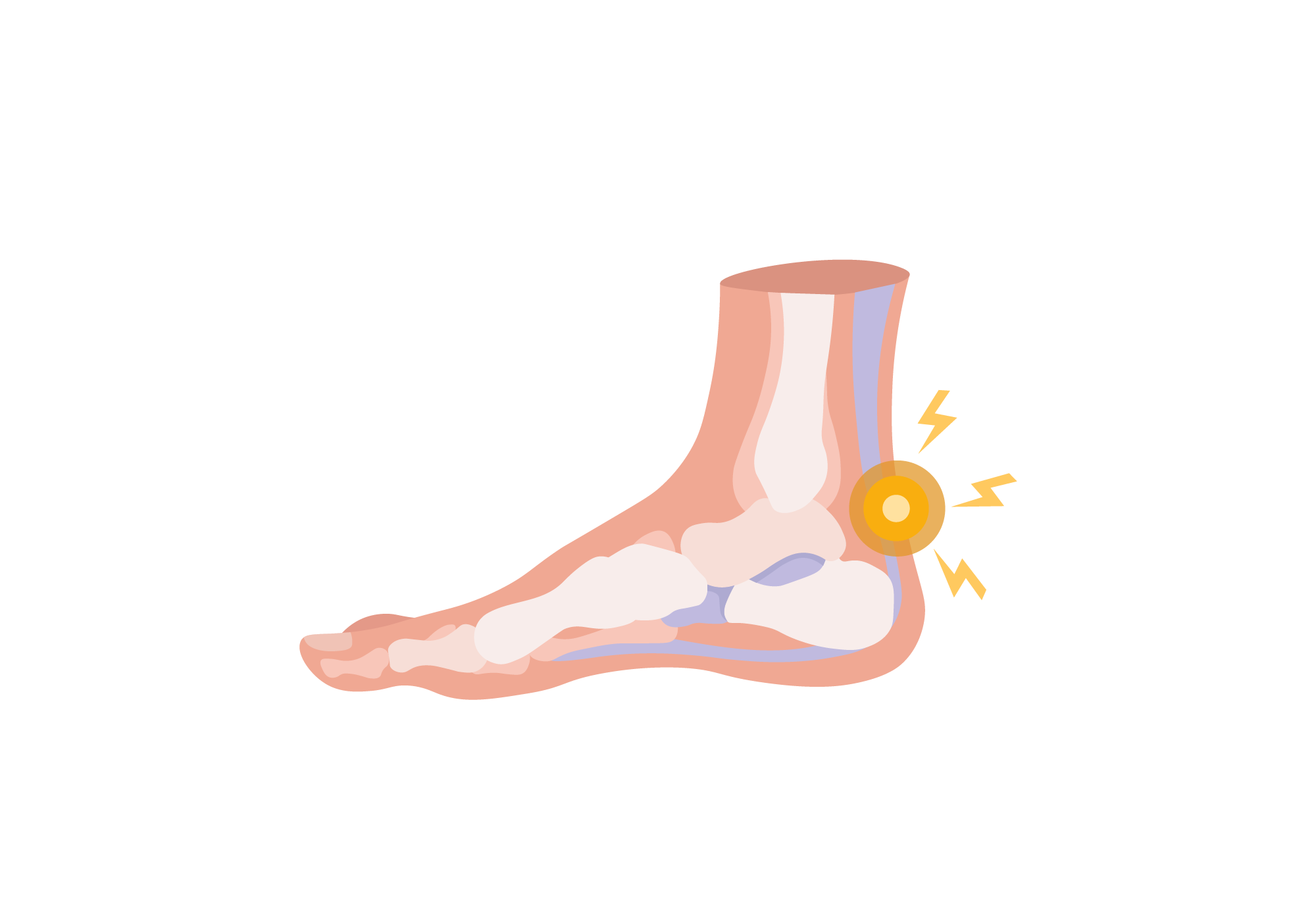 4 Heel Pain Symptoms to Take Seriously: Chicagoland Foot and Ankle: Board  Certified Foot and Ankle Specialists and Surgeons