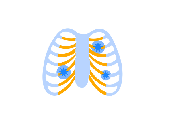 A light blue ribcage with yellow sections close to the sternum. Three blue star-shaped spots with lighter blue circles around them are on the yellow sections.