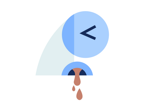 An illustration of a light green and blue nose from the side. The eye is squeezed shut in distress. Red blood drips from the nostril.