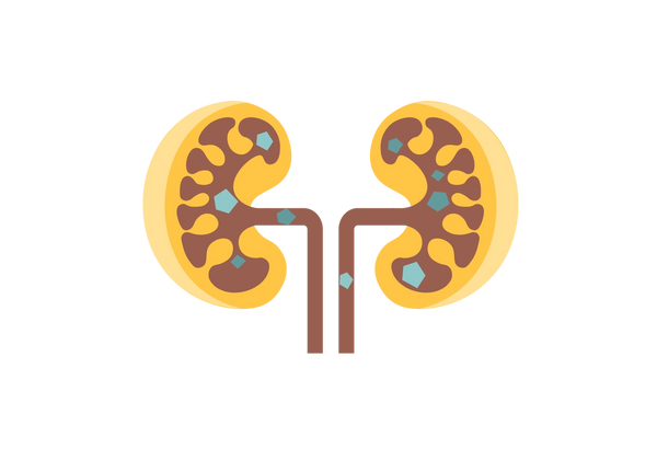 Two yellow kidneys with brown shapes running through them. Blue and green pentagons dot the brown canals.