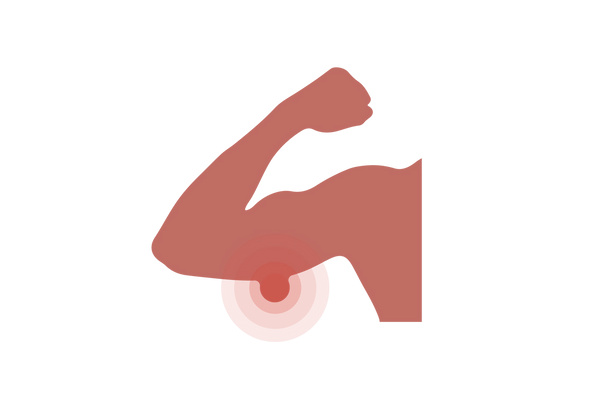 Uma ilustração do braço direito flexionado de uma pessoa. Sua pele é de tom médio de pêssego e há uma protuberância vermelha na parte inferior do braço. Círculos concêntricos translúcidos vermelhos vêm da colisão.
