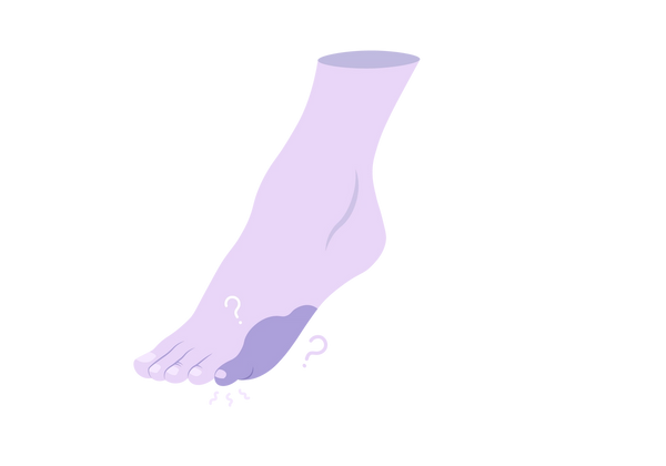 An illustration of a light purple foot facing left. The pinky toe has a darker purple splotch surrounding it. Two light purple question marks and three squiggles are around the pinky toe.