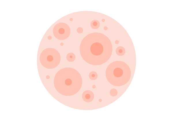 Eine abstrakte Illustration, die einen kreisförmigen Fleck von Molluscum Contagiosum darstellt. Der Kreis ist hell pfirsichfarben, wobei etwas dunklere Kreise die Molluske darstellen. Die meisten von ihnen haben kleinere Vertiefungen in der Mitte, die einen Farbton dunkler sind als die Kreise.