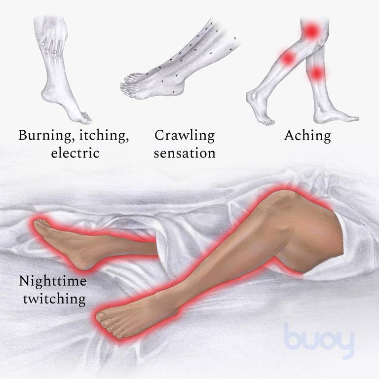 specificatie Voorafgaan pad Restless Legs Syndrome | Symptoms, Causes, and Treatments