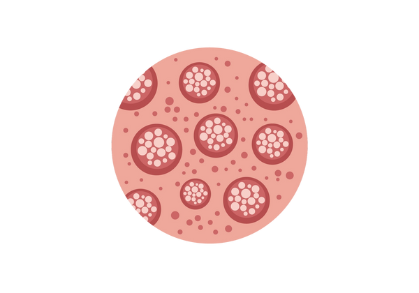 A pink circle with smaller dark pink circles inside. Each of the dark pink circles is filled with smaller white dots, and dark pink dots speckle the areas between these circles.