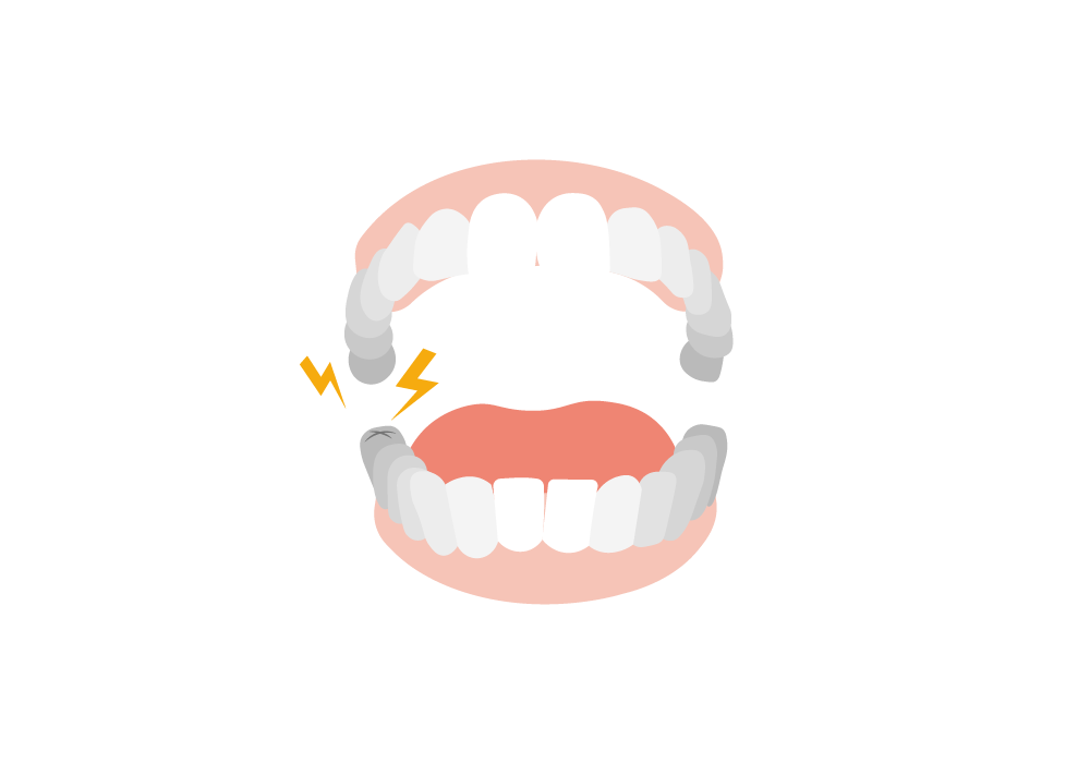 Molar Pain | 5 Causes of Molar Teeth Pain, Treatment & More | Buoy