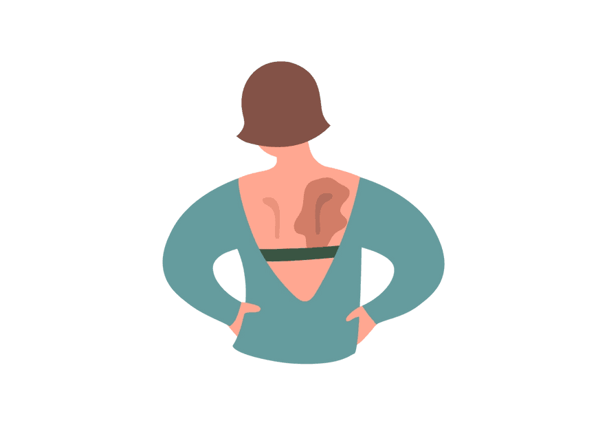 Shoulder Blade Pain When To Know It S Serious Buoy Shoulder Blade Pain When To Know It S Serious Buoy
