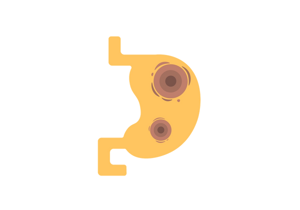 Estómago amarillo con dos conjuntos de círculos concéntricos marrones en el interior.