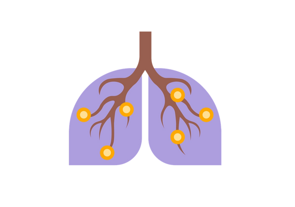 Pulmões com inflamação nas vias respiratórias