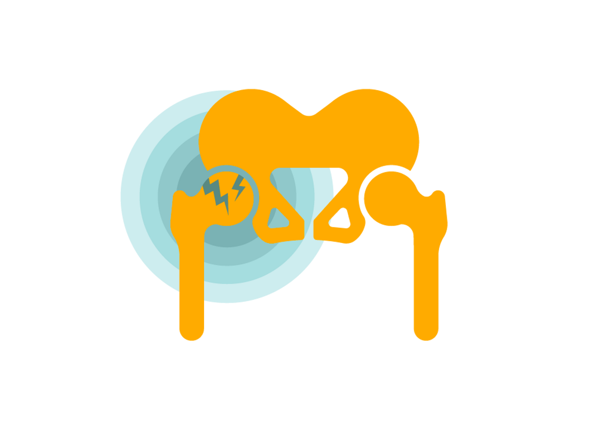 Hip Fracture Can I Still Walk, Treatment & Recovery Buoy