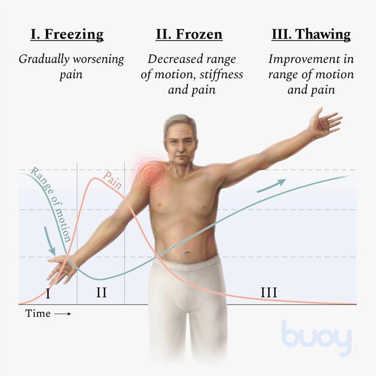 does frozen shoulder hurt when thawing