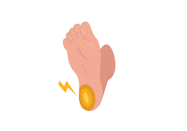 Ilustração de um pé em tom pêssego claro, mostrando a sola e o calcanhar. O calcanhar tem ovais concêntricos amarelos iluminando-se em direção ao centro, e um raio amarelo vem do calcanhar.