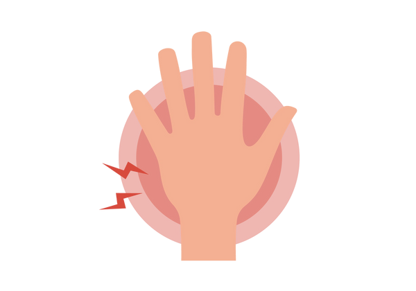 Hand Pain | 8 Hand Pain Causes & When to See a Doctor | Buoy