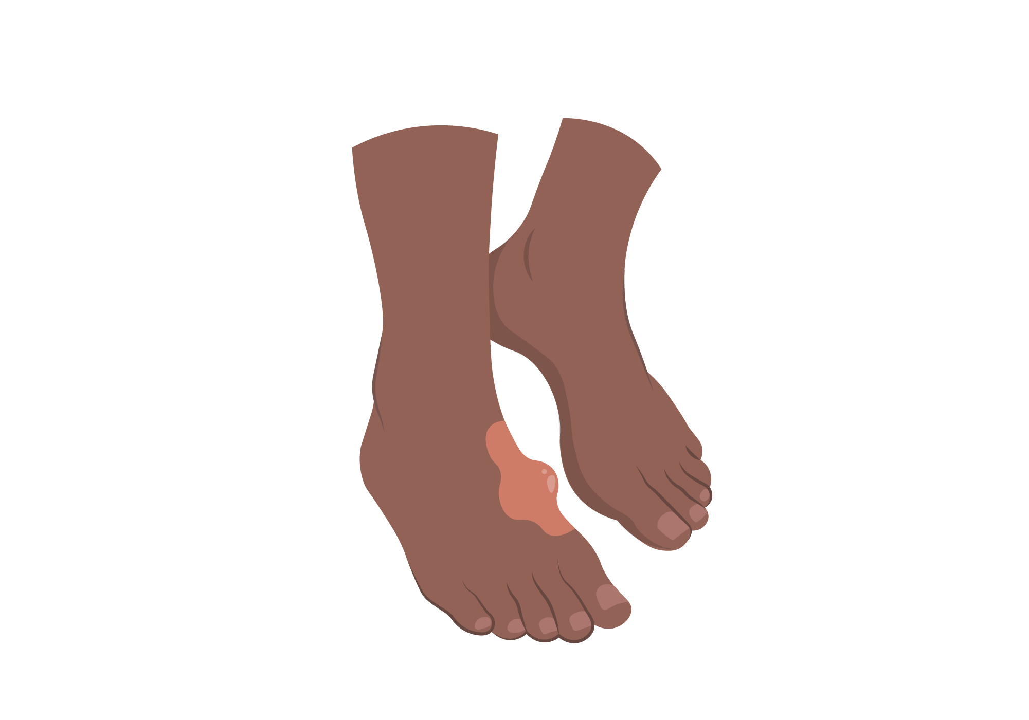 Hard Lump on Foot Causes | How to Eliminate a Hard Foot Lump