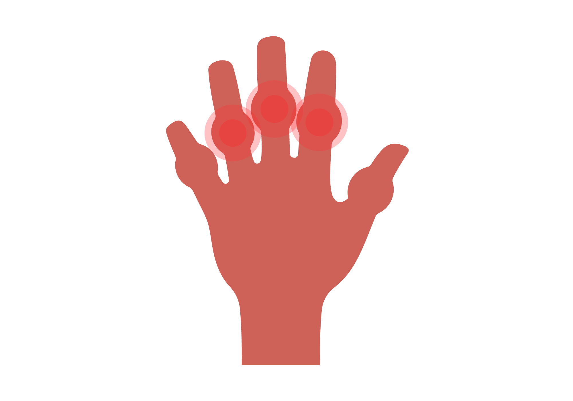 Why Are My Fingers Swollen? Top 10 Swollen Finger Causes | Buoy