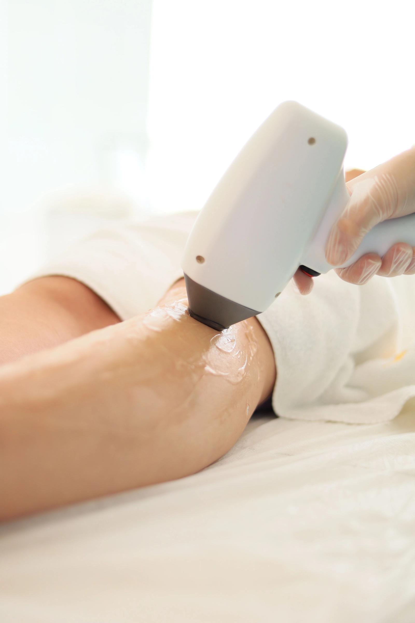 Close-up of a laser hair removal device being used on a forearm in a clinic