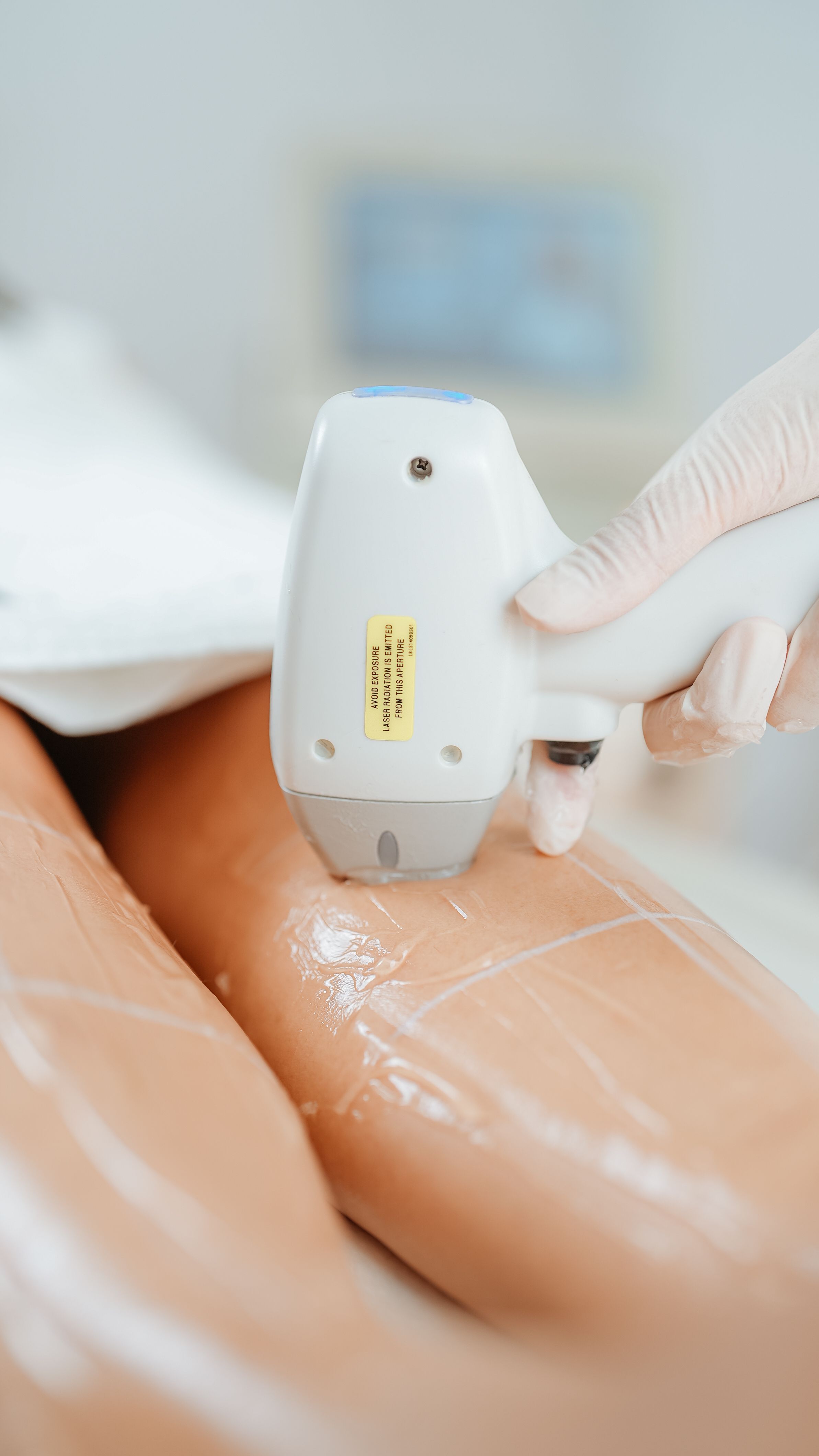 Close-up of a laser hair removal handpiece being applied to a client's leg in a clinic