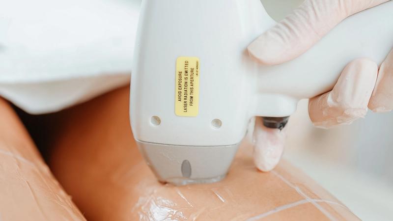 Close-up of a laser hair removal handpiece being applied to a client's leg in a clinic