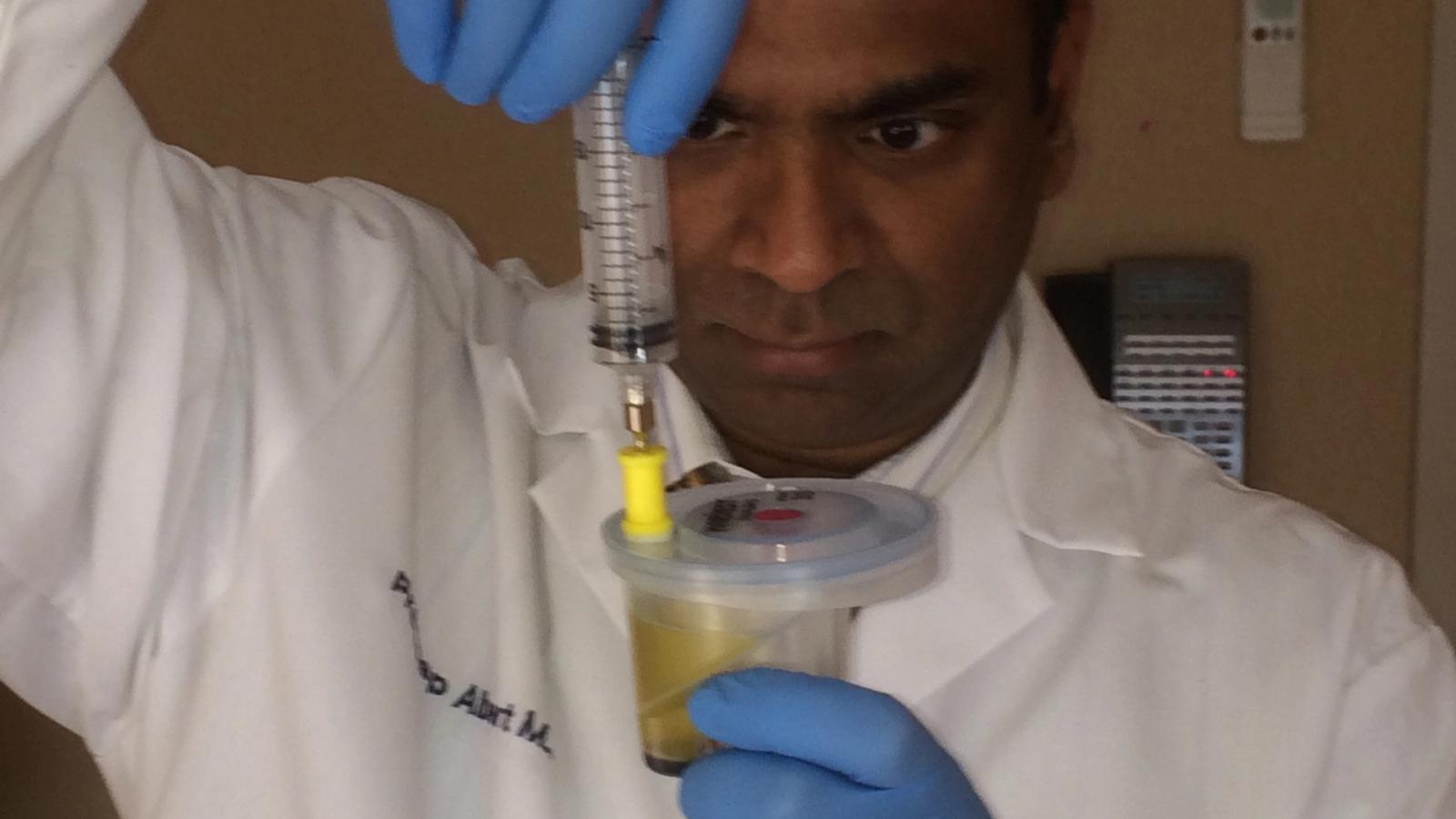 Clinical centrifuge test tube showing separated platelet-rich plasma layer above red blood cells in an aesthetic clinic lab