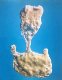 Naomi Livia, "Egg White II" from "Fried Egg Portraits" | DER GREIF
