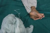 Prasamsha Paudel (17), hospitalized on her third day at Parbat Hospital. | DER GREIF