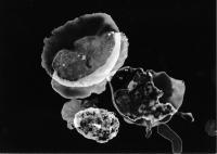 Emma Godfrey Pigott, 022 The Last Snowball, Gryon, CHE | DER GREIF