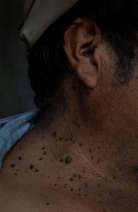 From the series "Raízhambre" | DER GREIF