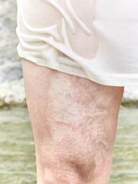 Accident | DER GREIF