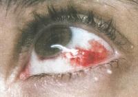 Michaela Knizova, From the series "Apparitions", Luxembourg, 2025 | DER GREIF