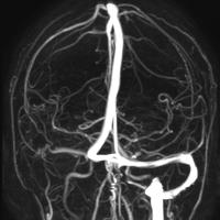 From the series "Beyond Fragments" | DER GREIF