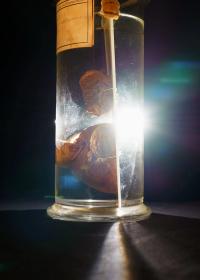 From the series "Vorwiegend festkochend / Sprouts & Skins" | DER GREIF