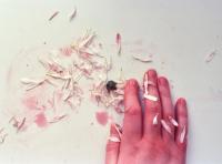 From the series "Dreams and Thorns", Malyn, Ukraine, 2024 | DER GREIF