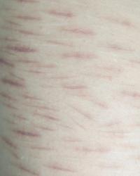 Benni Giammari, From "Senza Pelle", Milano, Italy, 2024 | DER GREIF