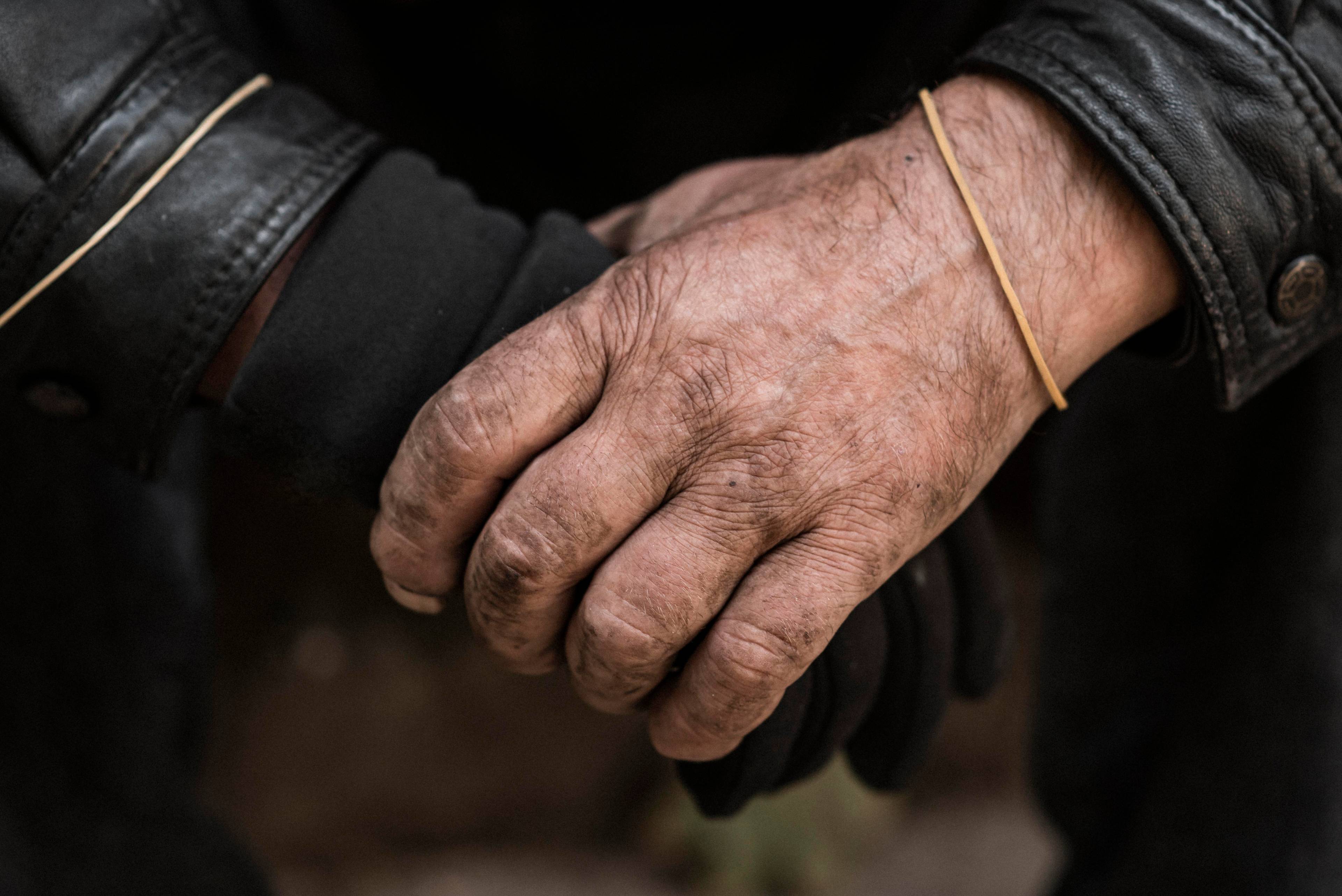 Close up of homeless person's hands