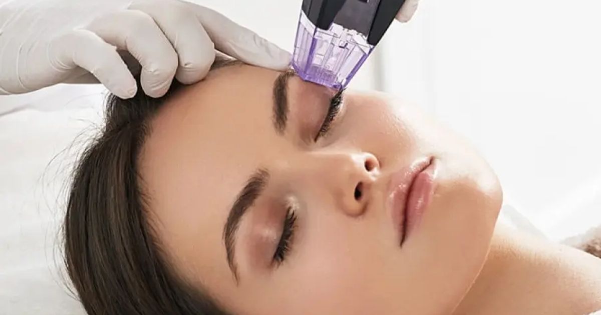 Morpheus8 RF Microneedling Sherman Oaks | Blue Medi Spa | Blue Medi Spa
