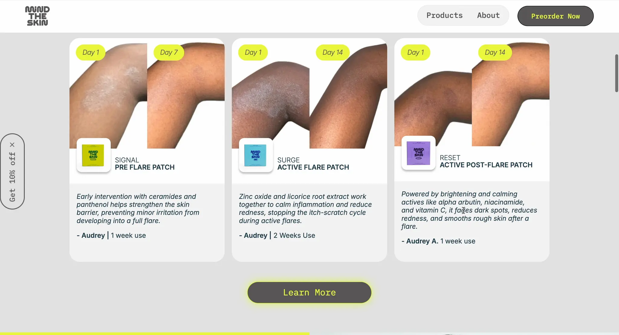 Three before-and-after cards on the Mind The Skin homepage pairing Day 1 and Day 7 or Day 14 photographs of eczema-affected skin, each labelled with the Signal, Surge or Reset patch used.